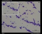 Listeria monocytogenes on blood agar